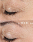 Image of a woman before and after using the product.